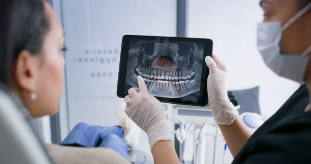 Licensed Tooth Extraction service in Fayetteville, GA - Smile Center Dentistry
